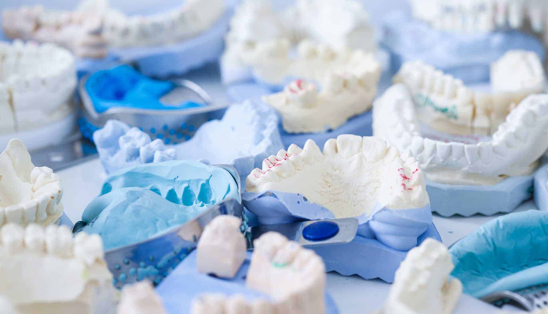 Denture and implant production: variety of dental plaster moulds and imprints with metal stock trays
